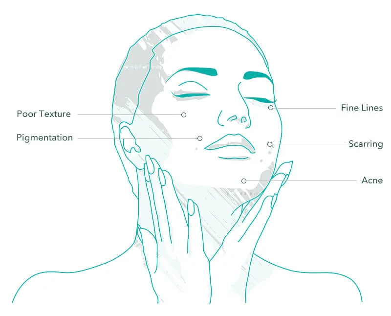 wow-facial-treatment-areas-in-milton-keynes-shujo-aesthetics