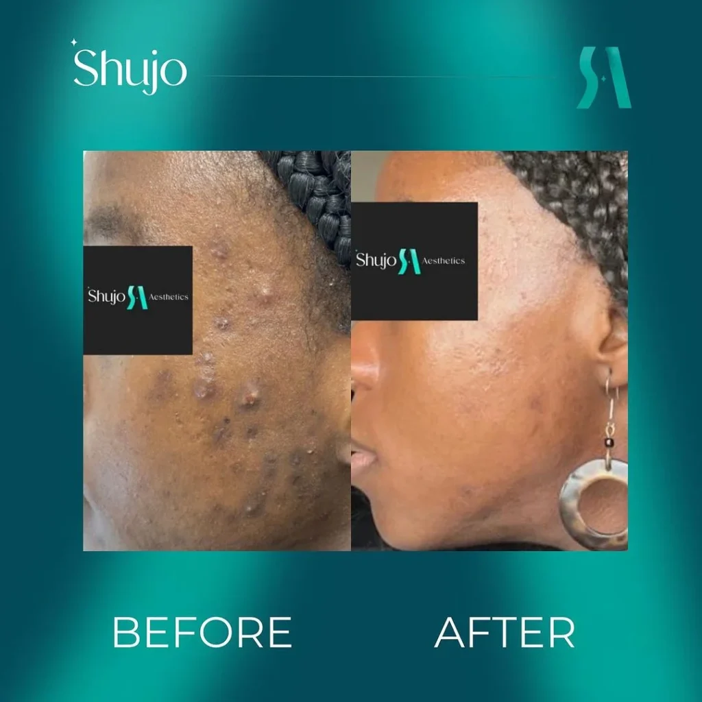 client result- shujo aesthetics